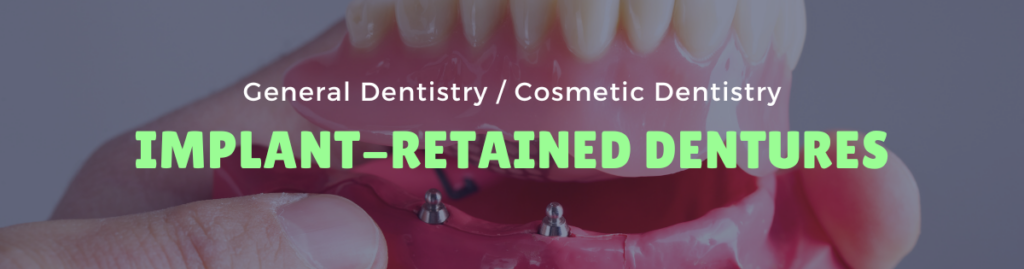 Implant Retained Dentures Lanie Family Dentistry