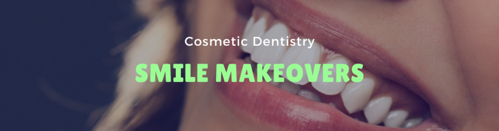 Smile Makeovers Lanie Family Dentistry